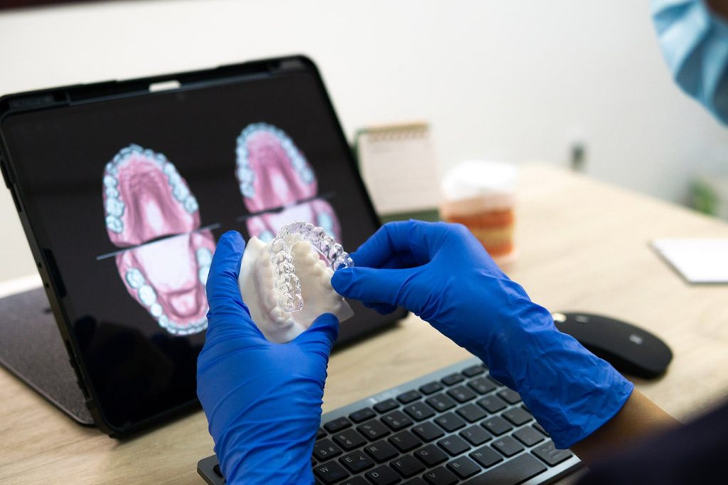 Sports Guards - Impressions Dental Laboratories